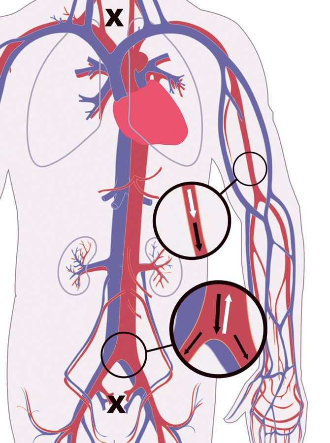 blodkärl och hjärta, blodomlopp